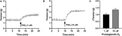 Prostaglandin E2 and F2alpha Modulate Urinary Bladder Urothelium, Lamina Propria and Detrusor Contractility via the FP Receptor